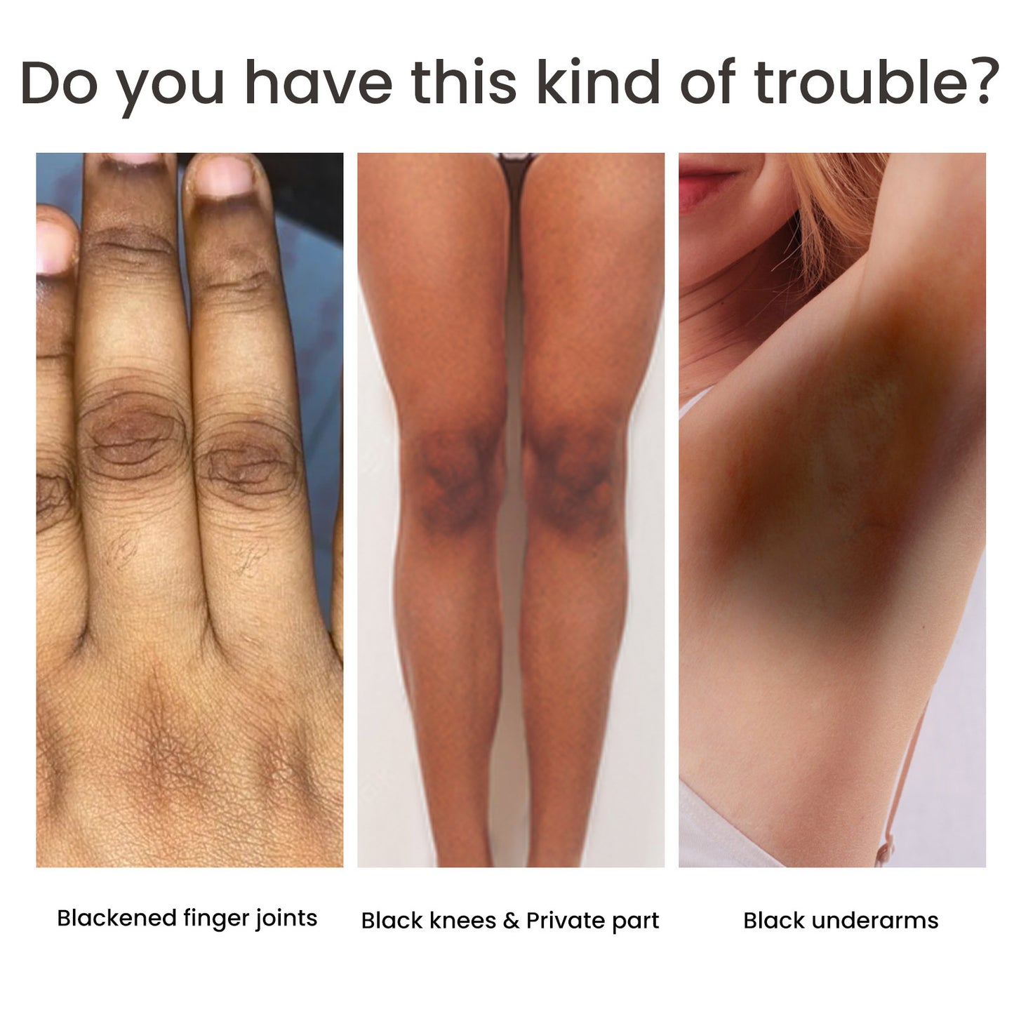 Brightening Serum for Dark Spots - Advanced Pigmentation Care